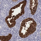 Immunohistochemical staining of human endometrium shows strong cytoplasmic positivity in glandular cells.