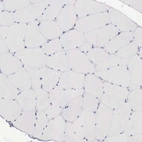 Immunohistochemical staining of human skeletal muscle shows no positivity in myocytes as expected.