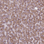 Anti-AMMECR1 Antibody