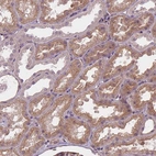 Immunohistochemical staining of human kidney shows moderate granular cytoplasmic positivity in cells in tubules.
