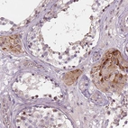 Immunohistochemical staining of human testis shows moderate granular cytoplasmic positivity in Leydig cells.