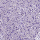 Anti-AMMECR1 Antibody