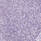 Immunohistochemical staining of human pancreas shows no positivity in exocrine glandular cells as expected.