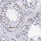 Immunohistochemical staining of human testis shows strong nuclear positivity in cells in seminiferous ducts.
