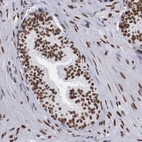 Immunohistochemical staining of human prostate shows moderate to strong nuclear positivity in glandular cells.