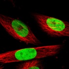 Immunofluorescent staining of human cell line U-251 MG shows localization to nucleoplasm.