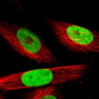 Immunofluorescent staining of human cell line U-251 MG shows localization to nucleoplasm.
