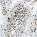 Immunohistochemical staining of human testis shows strong nuclear positivity in cells in seminiferous ducts.