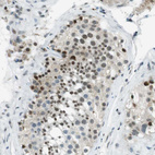 Anti-PJA1 Antibody