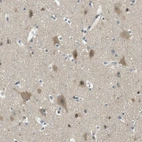 Immunohistochemical staining of human cerebral cortex shows moderate cytoplasmic and nuclear positivity in neurons.