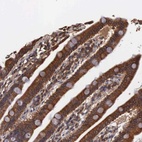Anti-DHRS1 Antibody