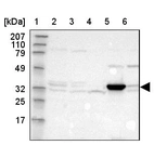 Lane 1: Marker [kDa] 207, 110, 79, 49, 32, 25, 17_br/_Lane 2: Human cell line RT-4_br/_Lane 3: Human cell line EFO-21_br/_Lane 4: Human cell line U-138MG (DSMZ)_br/_Lane 5: Human liver tissue_br/_Lane 6: Human tonsil tissue