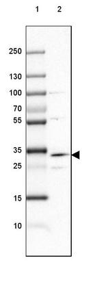Lane 1: Marker [kDa] 250, 130, 100, 70, 55, 35, 25, 15, 10_br/_Lane 2: Human Cerebral Cortex tissue