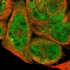 Immunofluorescent staining of human cell line A-431 shows localization to nucleoplasm, cytosol & centrosome.