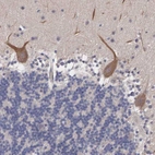 Anti-ABHD4 Antibody