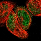 Immunofluorescent staining of human cell line A-431 shows localization to nucleoplasm.