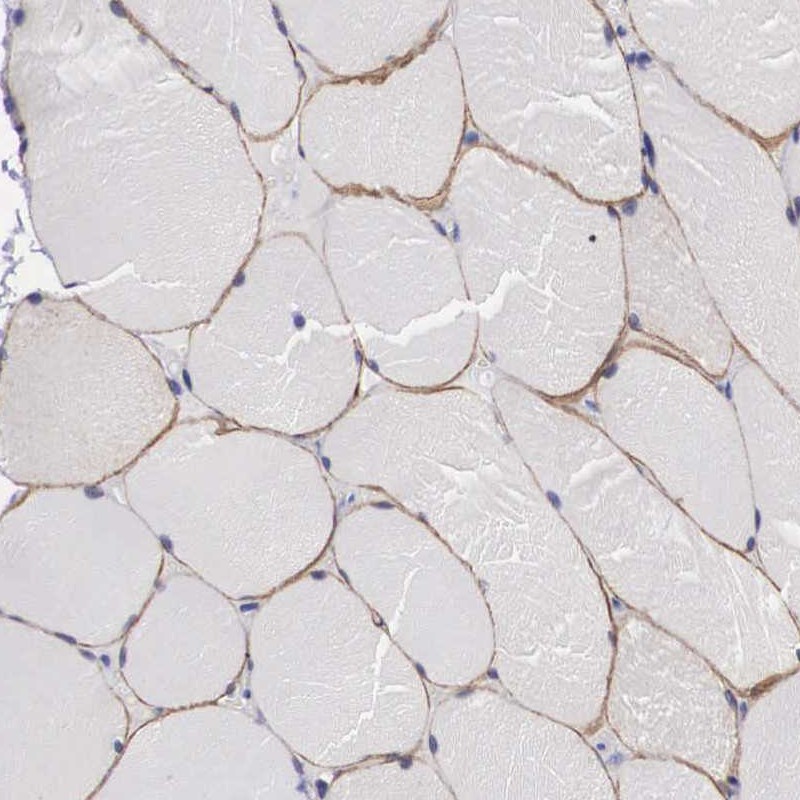 Anti-C22orf31 Antibody