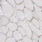Anti-C22orf31 Antibody
