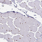 Anti-EMD Antibody