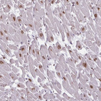 Immunohistochemical staining of human heart muscle shows strong positivity in nuclear membrane in cardiomyocytes.