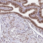 Immunohistochemical staining of human fallopian tube shows moderate positivity in nuclear membrane in glandular cells and smooth muscle cells with additional weak cytoplasmic positivity.