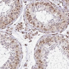 Immunohistochemical staining of human testis shows moderate positivity in nuclear membrane in cells in seminiferous ducts and leydig cells with weak cytoplasmic positivity.