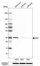 Western blot analysis in RT-4 cells transfected with control siRNA, target specific siRNA probe #1 and #2, using Anti-EMD antibody. Remaining relative intensity is presented. Loading control: Anti-GAPDH.