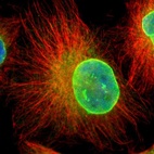 Immunofluorescent staining of human cell line U-251 MG shows localization to nuclear membrane & endoplasmic reticulum.