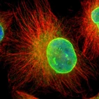 Immunofluorescent staining of human cell line U-251 MG shows localization to nuclear membrane & endoplasmic reticulum.