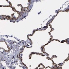 Anti-MAGEB10 Antibody