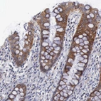 Immunohistochemical staining of human rectum shows granular cytoplasmic positivity in glandular cells.