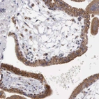 Immunohistochemical staining of human placenta shows granular cytoplasmic positivity in trophoblastic cells.