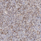 Immunohistochemical staining of human pancreas shows granular cytoplasmic positivity in exocrine glandular cells.