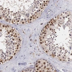 Immunohistochemical staining of human testis shows high expression.