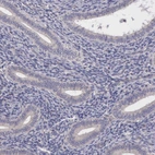 Immunohistochemical staining of human endometrium shows low expression as expected.