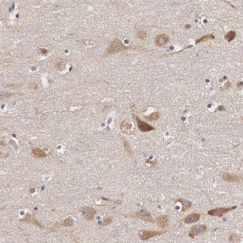 Anti-GRIPAP1 Antibody