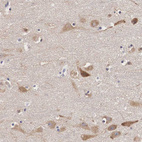 Anti-GRIPAP1 Antibody