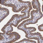 Immunohistochemical staining of human fallopian tube shows strong cytoplasmic positivity in glandular cells.