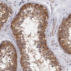 Immunohistochemical staining of human testis shows strong cytoplasmic positivity in cells in seminiferous ducts.
