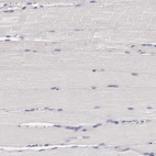 Immunohistochemical staining of human skeletal muscle shows no positivity in myocytes as expected.