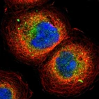 Immunofluorescent staining of human cell line A-431 shows localization to cytosol & vesicles.