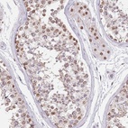 Anti-KLHDC2 Antibody