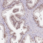 Anti-KLHDC2 Antibody