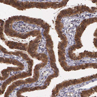 Anti-IGBP1 Antibody