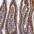 Immunohistochemical staining of human duodenum shows moderate cytoplasmic positivity in glandular cells.