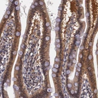 Immunohistochemical staining of human duodenum shows moderate cytoplasmic positivity in glandular cells.
