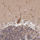 Immunohistochemical staining of human cerebellum shows moderate cytoplasmic positivity in Purkinje cells.