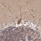 Immunohistochemical staining of human cerebellum shows moderate cytoplasmic positivity in Purkinje cells.