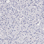 Immunohistochemical staining of human liver shows no positivity in hepatocytes as expected.