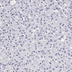 Immunohistochemical staining of human liver shows no positivity in hepatocytes as expected.